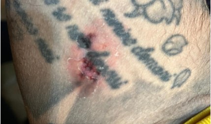 L’A.S.D. Città di Anagni Calcio replica alle notizie su un’aggressione in campo